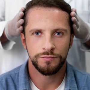 How is hair transplantation applied?
